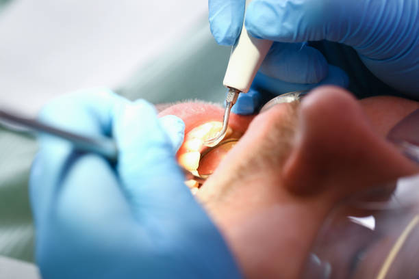 Best Emergency Treatment for Toothache in Lake Mack Forest Hills, FL